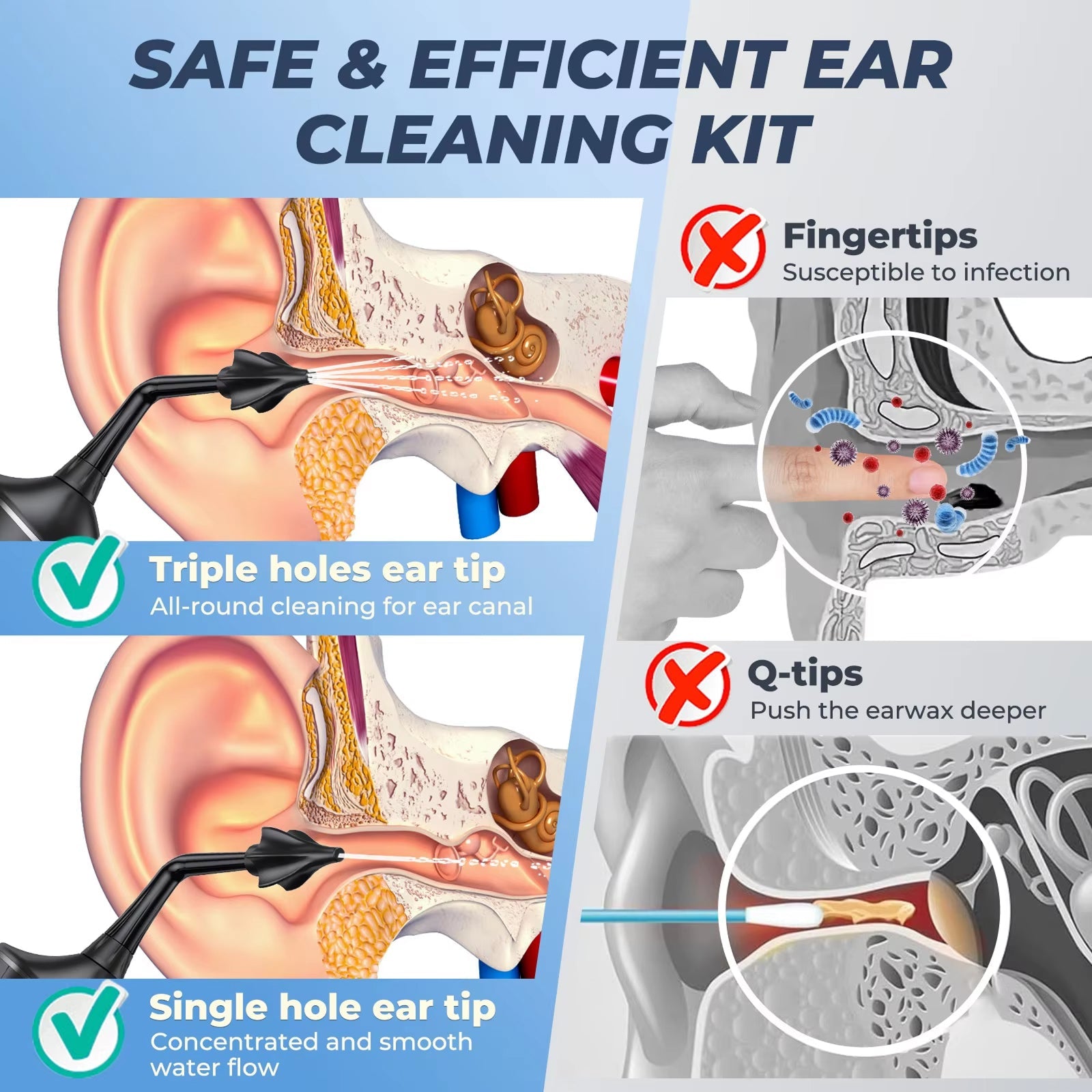 EarmBlis v2 Professional Water Irrigation Ear Wax Cleaner