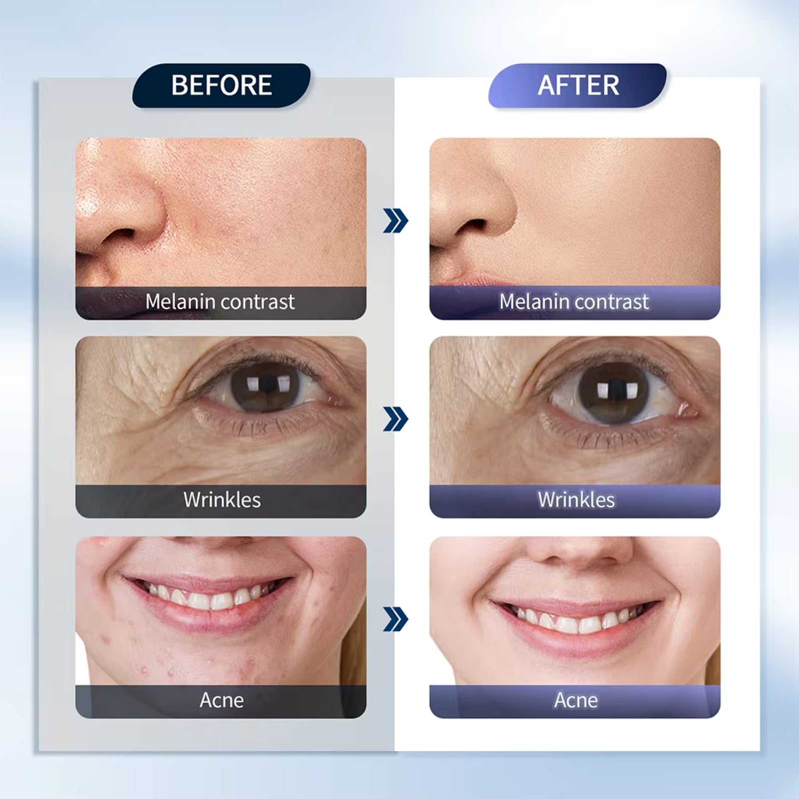 ErynoLux LED Face Mask with Ultrasonic Nano Spray Hydration