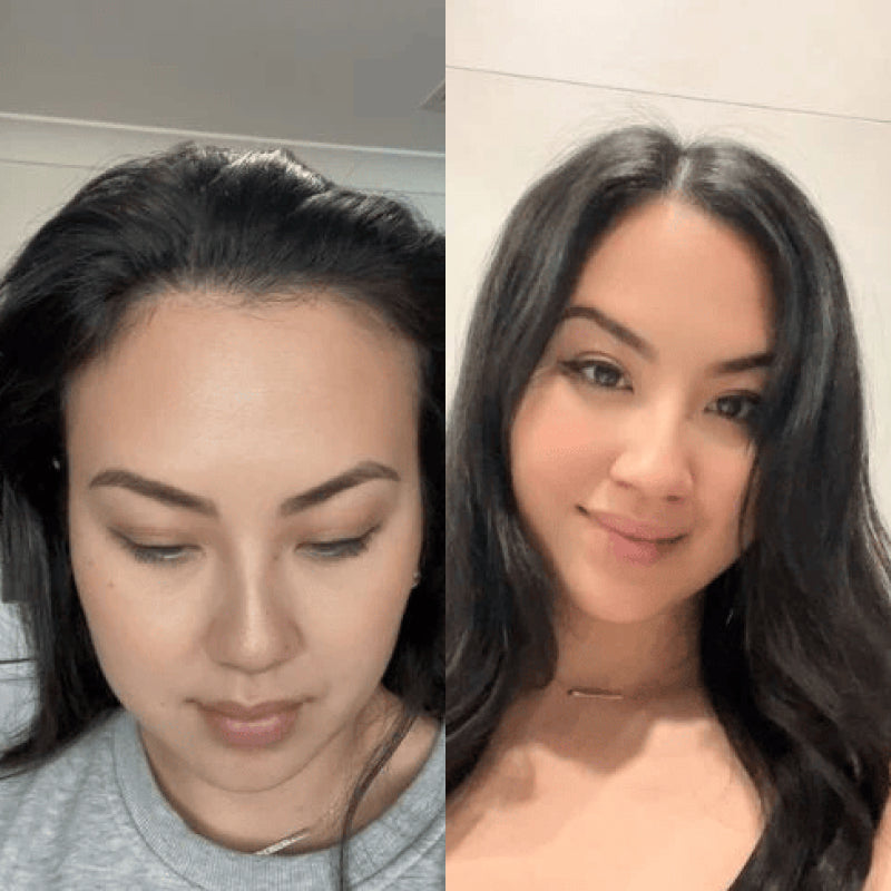 KomeeSol Red Light Therapy Hair Brush