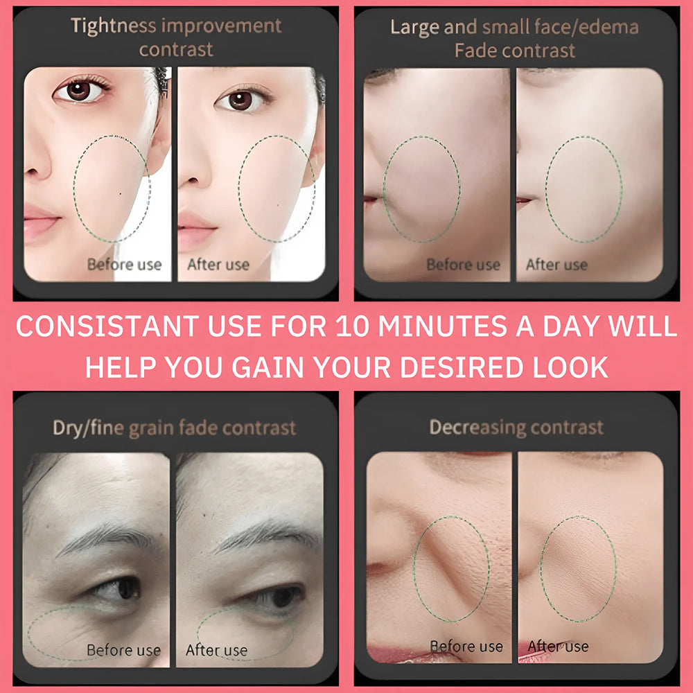 RevSculp Face Tightening Device