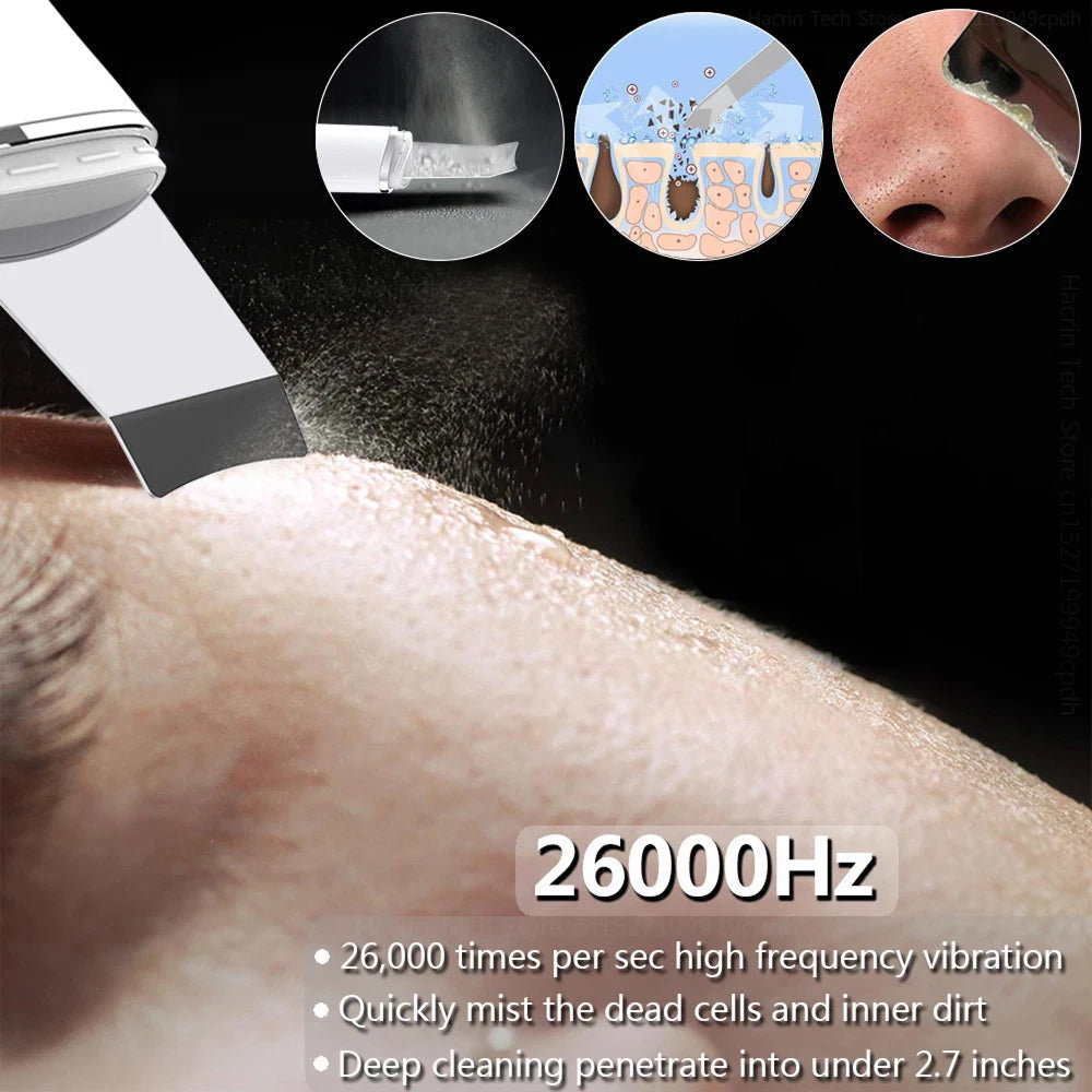 SkinSonyc v2 Ultrasonic Skin Scrubber & Pore Cleanser