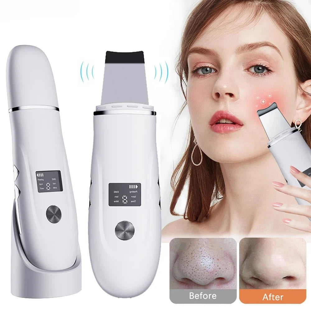 SkinSonyc v2 Ultrasonic Skin Scrubber & Pore Cleanser