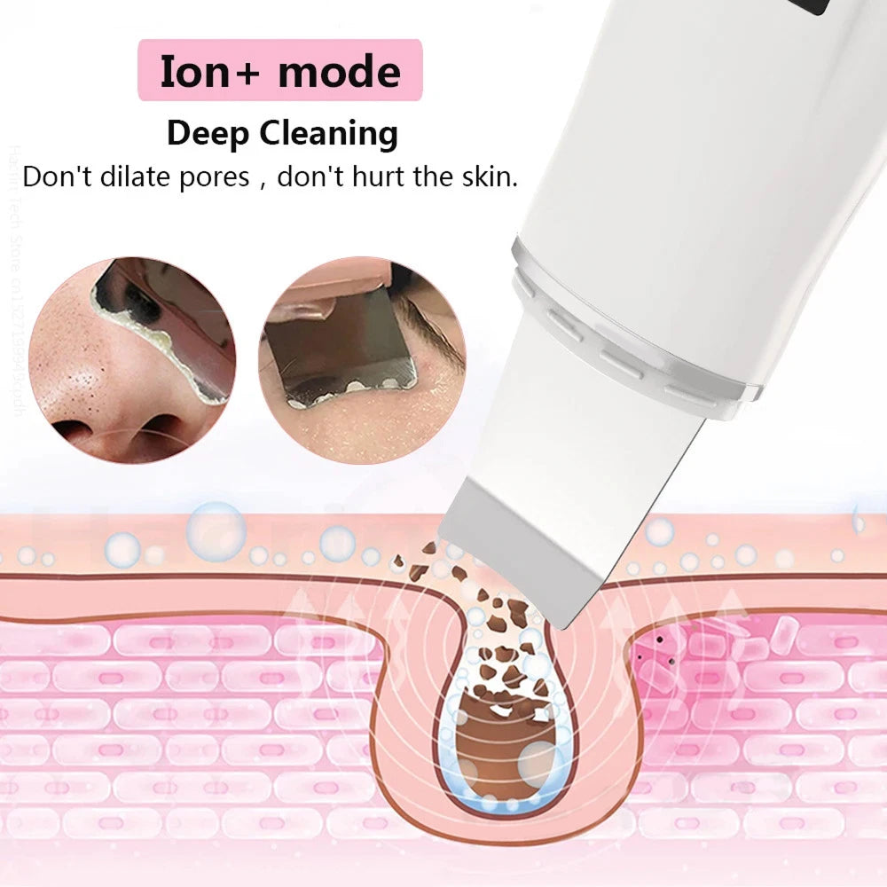 SkinSonyc v2 Ultrasonic Skin Scrubber & Pore Cleanser