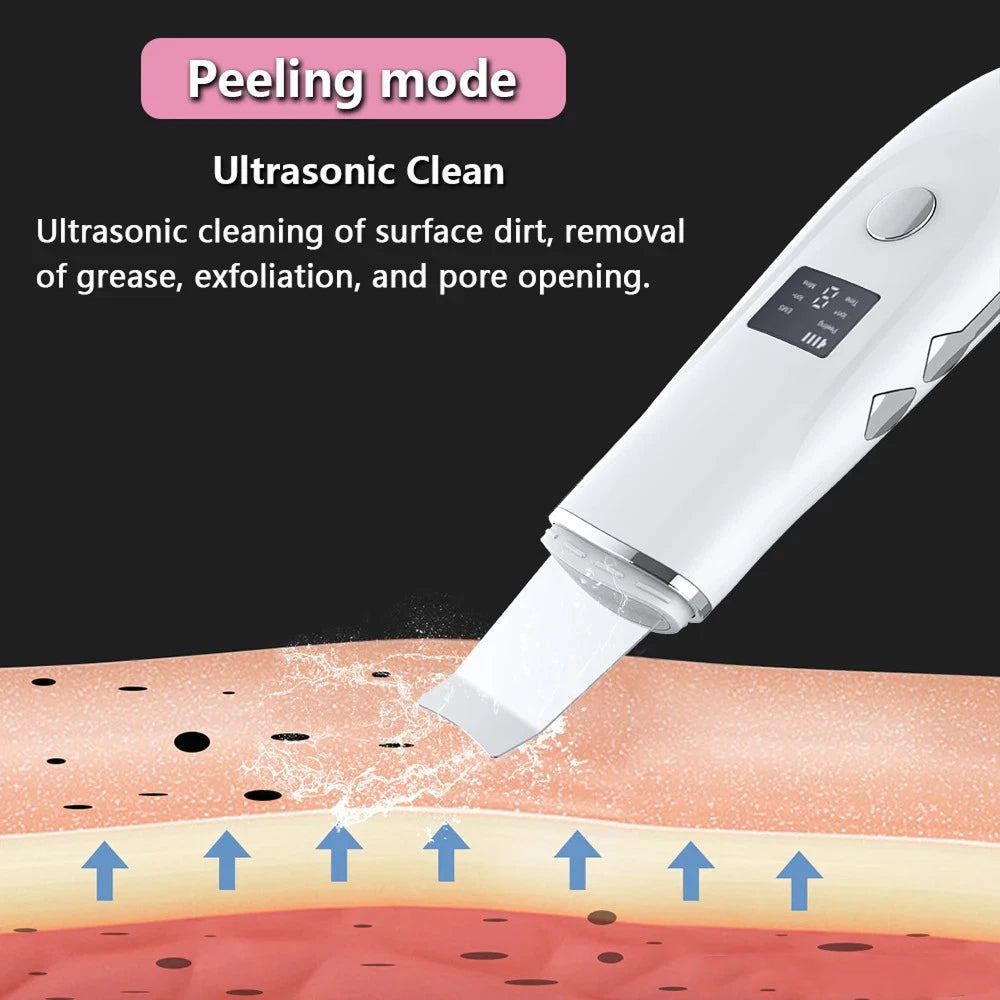 SkinSonyc v2 Ultrasonic Skin Scrubber & Pore Cleanser