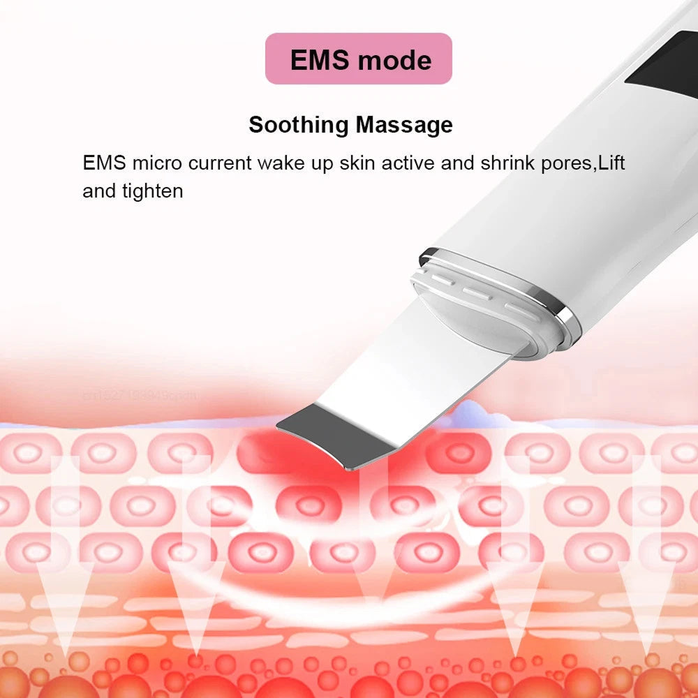 SkinSonyc v2 Ultrasonic Skin Scrubber & Pore Cleanser